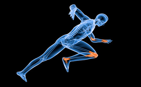 關(guān)節(jié)型牛皮癬注意,得了關(guān)節(jié)型牛皮癬怎么辦