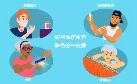 不同膚色牛皮屑發病人群