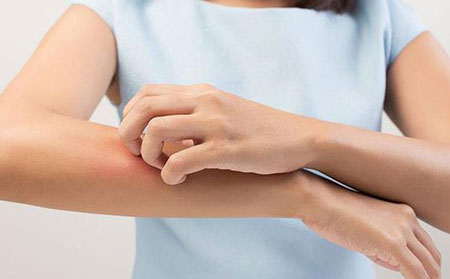 牛皮膚癬早期癥狀-皮膚發(fā)癢