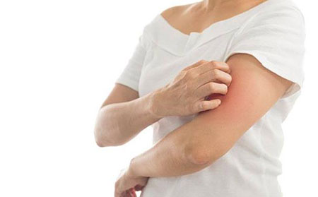 早期牛皮膚癬初期圖片癥狀