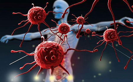 牛皮癬有什么發病因素-免疫系統弱