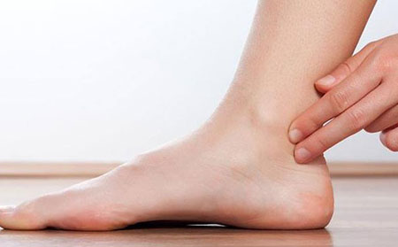 銀屑病關節炎癥狀分級