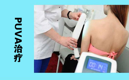 補骨脂素加紫外線(PUVA)