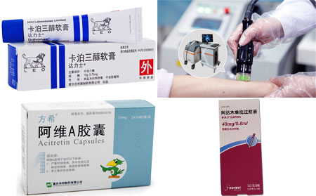 牛皮癬銀屑病生物制劑