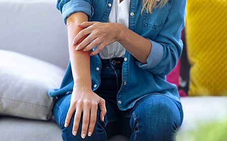 你是否患有銀皮膚癬或類似的皮膚病