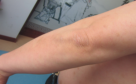 濰坊專業治療銀屑病醫院怎么選