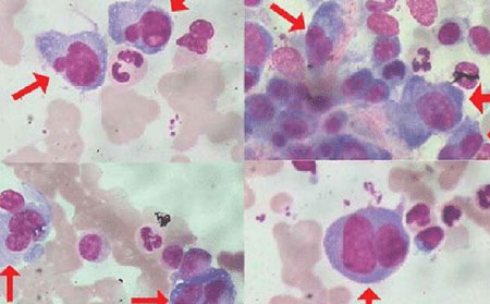 濰坊治療銀屑病醫院