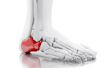 關節型銀屑病臨床圖片癥狀