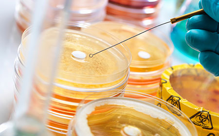 銀屑病患者往往有家族史和遺傳傾向。