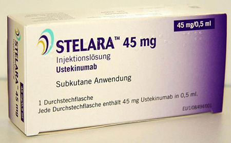 治療銀屑病的藥優(yōu)特克單抗