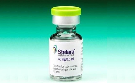 優(yōu)特克單抗治療牛皮癬生物制劑
