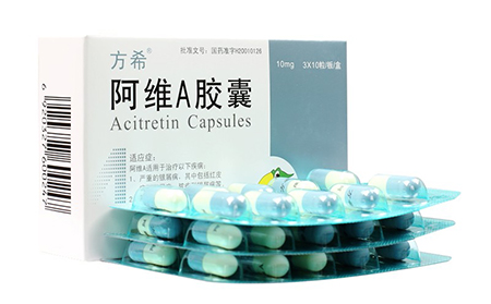 阿維A（Soriatane）治療銀屑病牛皮癬