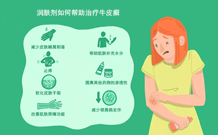 使用潤膚劑治療牛皮癬