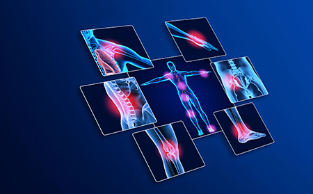 銀屑病關(guān)節(jié)炎圖片早期好治嗎