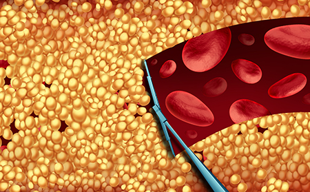 牛皮膚癬治療方案開始之前需要做好相關(guān)檢查