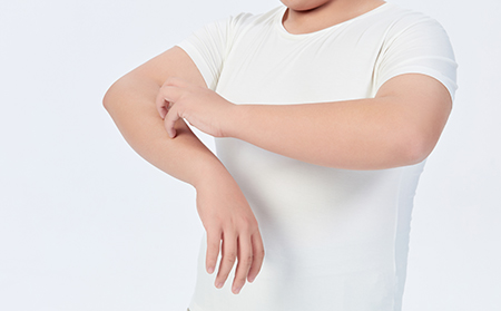 可以根據您的體檢診斷出牛皮膚癬