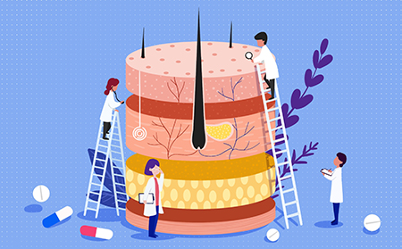 牛皮膚癬是一種慢性皮膚病，會導致鱗屑和炎癥。