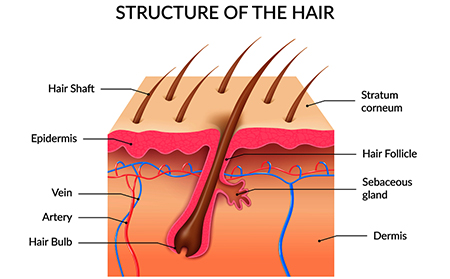 頭部銀屑病擴(kuò)散頭皮銀屑病護(hù)理方法