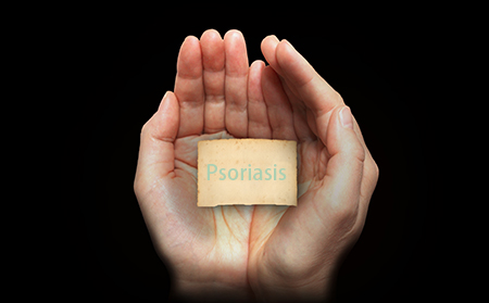 手心銀屑病癬的癥狀圖片
