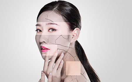 牛皮膚癬尋常型的好治療嗎