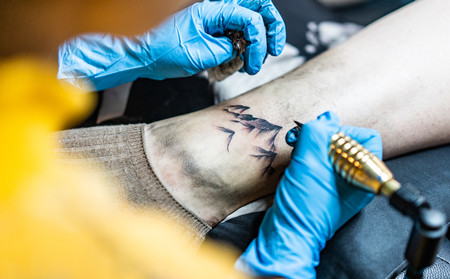 護(hù)理銀屑病方法,有銀屑病怎樣護(hù)理,濰坊東方