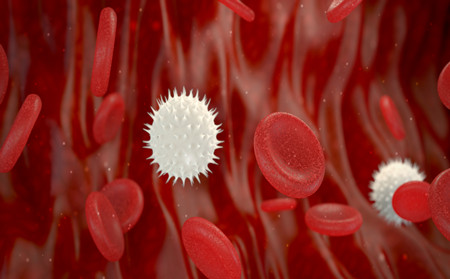 銀翹病,銀翹病病因,銀屑病醫院