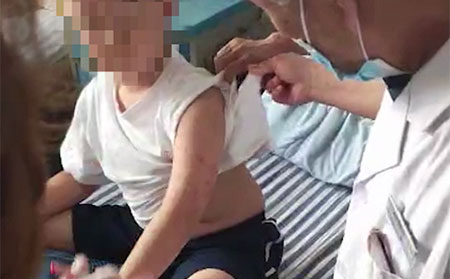 江蘇銀屑病醫(yī)院,宿遷治療銀屑病方法哪種很好