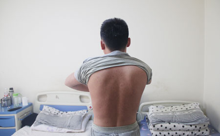 銀肖病,銀肖病癥狀,濰坊東方銀屑病研究院